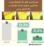 سرم ضدلک و روشن کننده اکسیس وای - Image 5