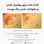بوستر شات ویتامین سی آرنسیا| روشن‌کننده قوی انواع تیرگی - Image 7