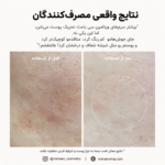 بوستر شات ویتامین سی آرنسیا| روشن‌کننده قوی انواع تیرگی - Image 8