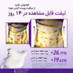 کرم رتینول و کلاژن آنوا مدل Gua Sha| لیفت صورت و ضد چروک گردن - Image 3