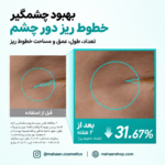 کرم دور چشم آنوا PDRN و کافئین | آبرسان، ضدچروک و روشن‌کننده دور چشم Anua - PDRN Caffeine Rejuvenating Eye Cream - Image 5
