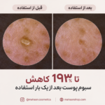 آمپول لایه بردار پیل شات برنج سفید دکتر ملاکسین | Dr.Melaxin Peel Shot Glow White Rice Ampoule - Image 4
